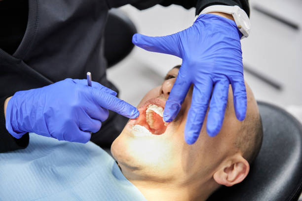 Best Emergency Dental Care for Sports Injuries in Luna Pier, MI