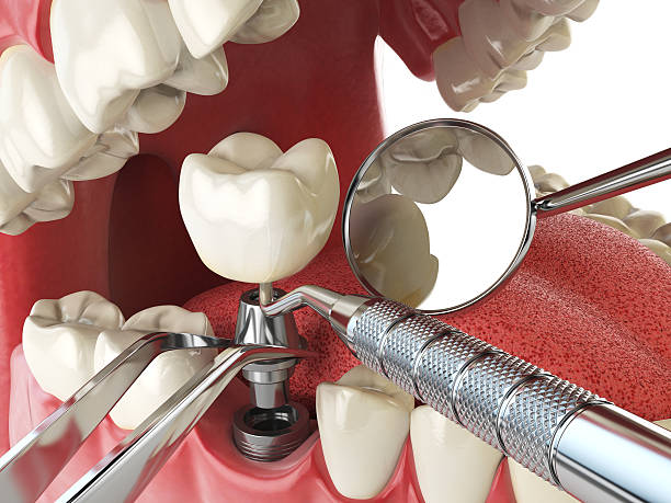 Best 24-Hour Emergency Dental Care in Luna Pier, MI